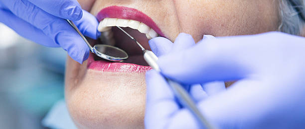 Best Emergency Root Canal Treatment in Attleboro, MA